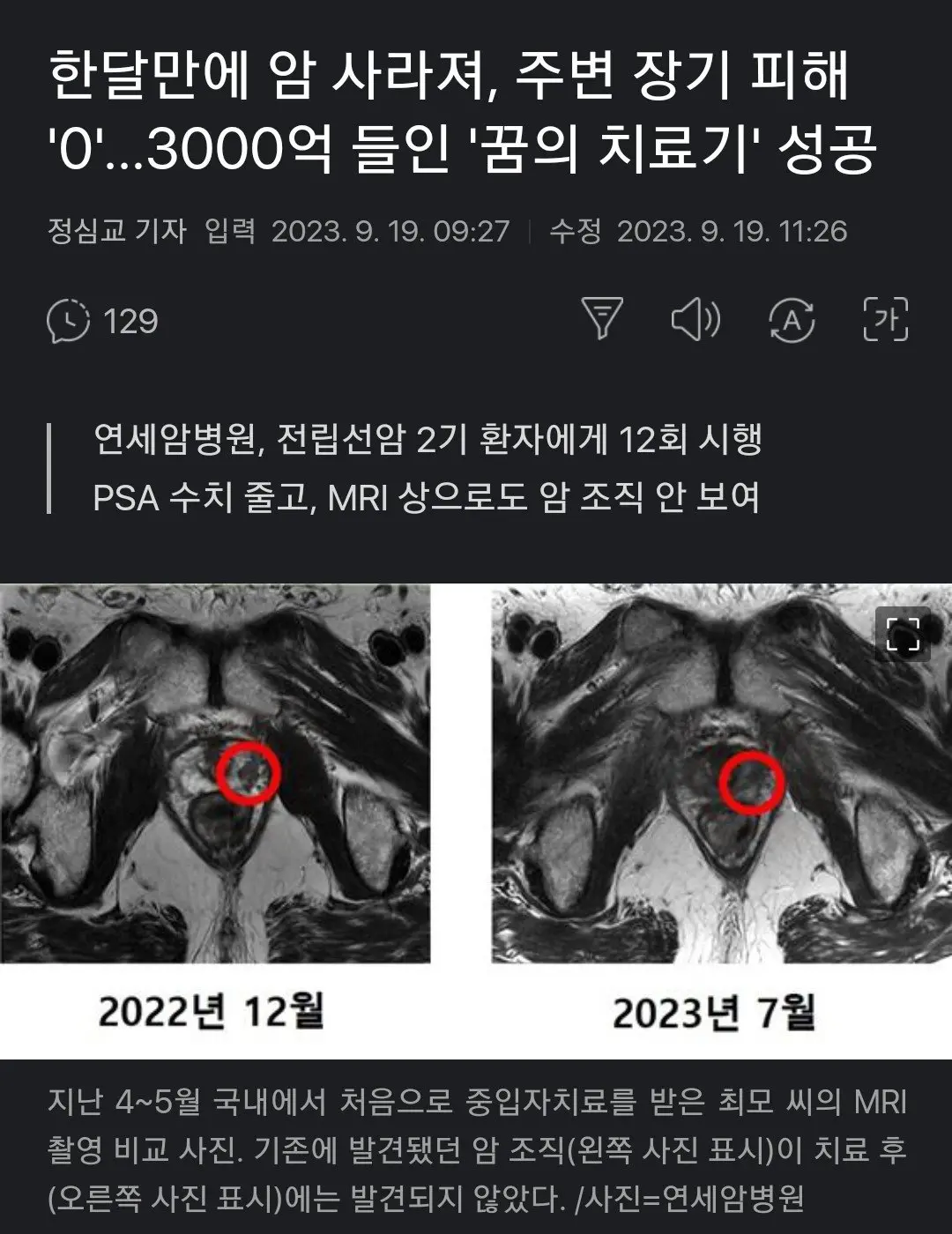 연대 세브란스 암치료 근황 ㄷㄷㄷ | mbong.kr 엠봉
